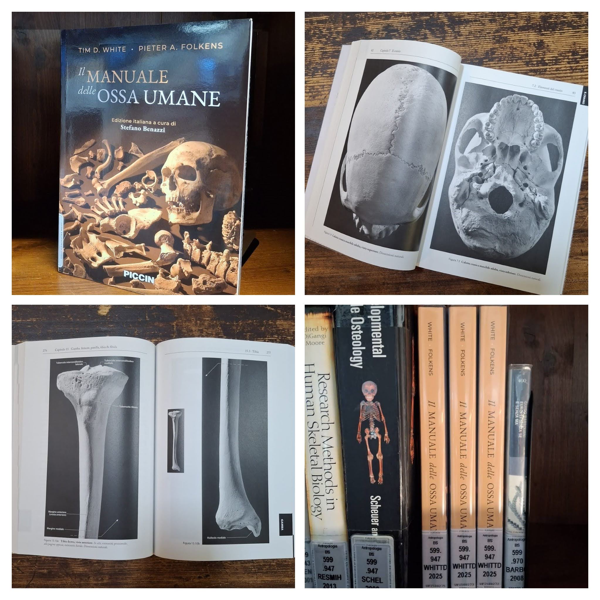 Manuale delle ossa umane, White e Folkens, edizione italiana
